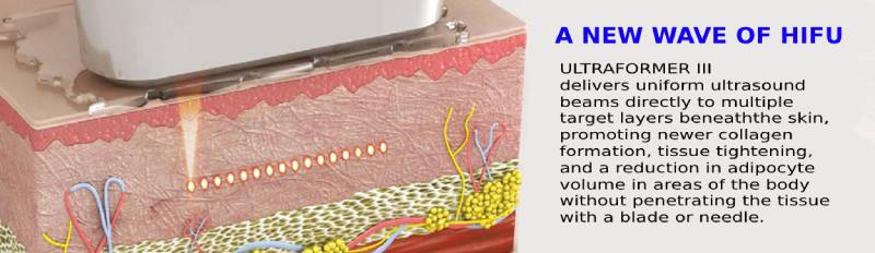 TOOLS, TIGHTENS, SHAPE